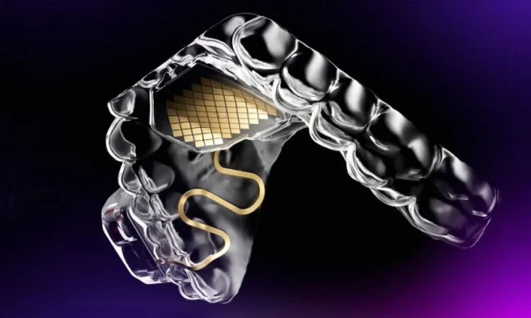MouthPad